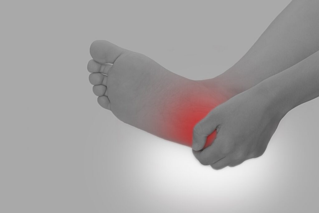 【足底腱膜炎】の痛みは整体と2つの体操で歩けるように！